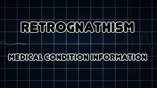 Retrognathism Medical Condition [upl. by Mccall529]