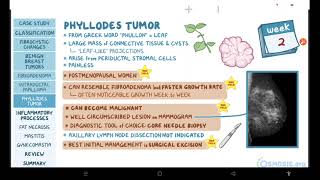 Benign breast conditions  pathology review  Osmosis [upl. by Philan]