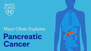 Mayo Clinic Explains Pancreatic Cancer [upl. by Eisenstark]