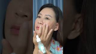 Merawat melasma bagi wanita lepas bersalin [upl. by Parfitt]