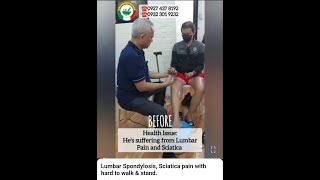 Lumbar Spondylosis Sciatica pain with hard to walk amp stand [upl. by Ellohcin950]