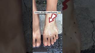 🔥Get Fair Feet  Easy Suntan Removal Pack At Home RemoveSuntan shortsytshortssuntandiyviral [upl. by Corley]