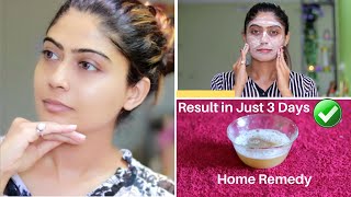 OMG 😮 This Facial Remove Your Dark Spots Brown Spots Pigmentation amp Pimples in just 3 Days [upl. by Latyrc]