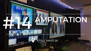 Atout Santé 14 Amputation la vie continue [upl. by Ailisab]