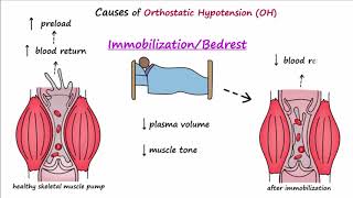 Orthostatic Hypotension Described Concisely [upl. by Hedgcock170]