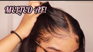 How to RE Install Frontal Wigs for Beginners  VERY DETAILED  Melt Transparent Lace [upl. by Evelina]