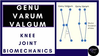 Tibiofemoral Alignment Knee joint biomechanics physiotherapy tutorials [upl. by Drarreg947]