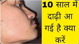 10 saal ki age main dadhi aa gai kya kare  beard ko trim karne ka tarika [upl. by Annasus]