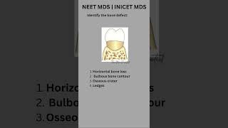 NEET MDS  INICET MDS preparation 2025  Periodontics [upl. by Woodrow]