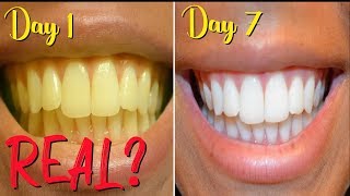 Whiter Teeth in TWO minutes REAL or FAKE howto teeth whitening [upl. by Jedediah]