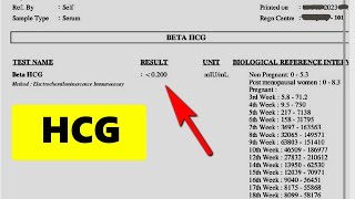 INTERPRET YOUR HCG RESULT LEARN IN 4 MINUTES [upl. by Eocsor]