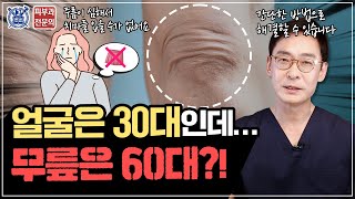 무릎 주름 그냥 두면 더 깊어집니다 100 효과 볼 치료법 공개 [upl. by Nalon]