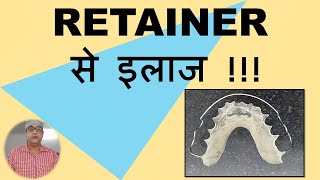 RETAINER TYPE BRACES REMOVABLE BRACES [upl. by Afira]