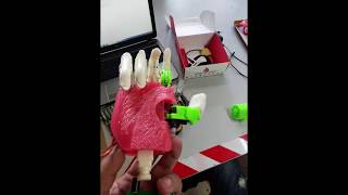 Biomedical Projects Bionic arm Hackberry [upl. by Pogah]