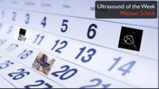 Ultrasound of the Week  Necrotizing pneumonia and tamponade [upl. by Jenei246]