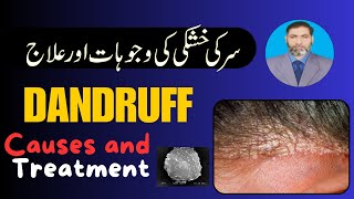 What is Dandruff Khushki its Causes and management [upl. by Alleroif]