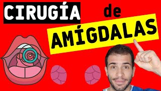 ✅ Cirugía de amígdalas AMIGDALECTOMÍA 👄 ¿Cuáles son los riesgos y complicaciones [upl. by Derag]