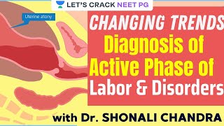 Changing Trends Diagnosis of Active Phase of Labor amp Disorders  NEET PG 2021  Dr Shonali Chandra [upl. by Nari]