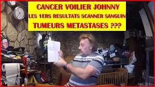 MES 1ERS RESULTATS SCANNER CANCER VOILIER JOHNNY SUN ODYSSEY 292 CLABI JOJO [upl. by Merrie978]