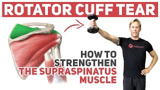 Rotator Cuff Tear How to Strengthen Supraspinatus [upl. by Jarret]