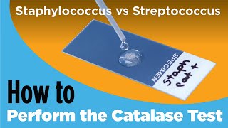 How to Perform the Catalase Test  Staphylococcus vs Streptococcus [upl. by Golding996]