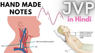 Jugular Venous Pressure  JVP Waveform  Explained in hindi [upl. by Devondra]