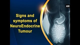 Signs and symptoms of NeuroEndocrine Tumour  ANI News [upl. by Yebot]