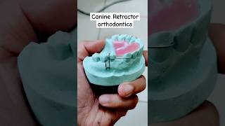 Reverse loop canine retractor ortho appliance [upl. by Liz966]