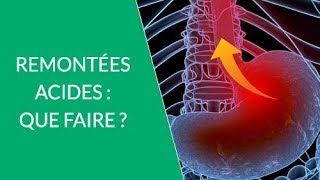 Remontées acides – Que faire pour les éviter [upl. by Davey]