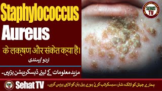 Staphylococcus Aureus Ki Alamat Tashkhees Aor Ilaj Urdu Hindi [upl. by Namor]