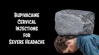 Cervical Injections for Headache in Honduras [upl. by Asquith]