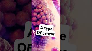 What is Burkitt Lymphoma lymphoma science cancer [upl. by Stier]