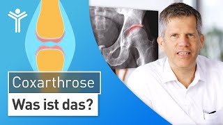 Coxarthrose einfach erklärt Ursachen amp Symptome  Hüftarthrose [upl. by Lidia560]