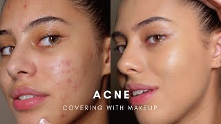 HOW TO COVER ACNE WITH MAKEUP BASE ROUTINE [upl. by Ttekcirc]