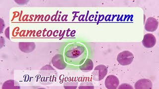 Plasmodia Falciparum Gametocyte  Morphology in Peripheral blood smear [upl. by Ethelred348]