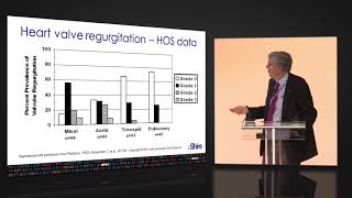 Cardiology MDT management of Hunter syndrome MPS II [upl. by Noelc]