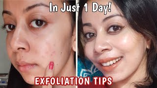 5 Exfoliation Tips for Clear Skin amp Glow How to exfoliate with Chemical Peels exfoliators [upl. by Patterman872]