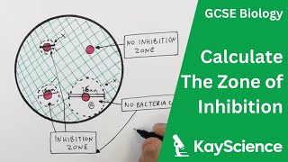 The Zone Inhibition in Bacterial Cultures  GCSE Biology  kaysciencecom [upl. by Lowrie]