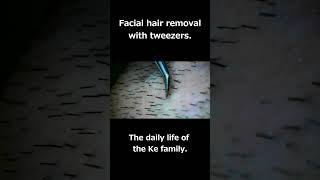 Facial hair removal with tweezers 1 髭の毛抜きFacial hair removal 毛抜き shorts [upl. by Ruskin]