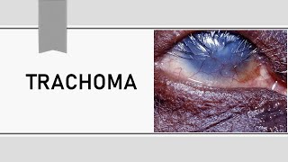 Trachoma Lecture [upl. by Maag]