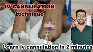 LEARN IV CANNULATION IN 2 MINUTES  How to do iv cannulation  iv cannulationmedical mbbs nursing [upl. by Kovar762]