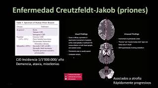 Radiología en 5 minutos Enfermedad Creutzfeldt Jakob Priones [upl. by Portie]