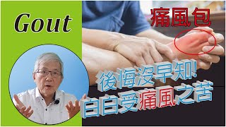 Gout I 後悔沒早知 I 白白受痛風之苦 I pain I 泡菊花茶 I 消炎 I 抗氧化 I 抗尿酸 I 治療痛風 I 人參粉 I Ginseng I Samuel Sit [upl. by Ertha905]