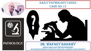 DAILY PATHOLOGY CASES CASE NO 13 BY Dr WAFAEY BADAWY [upl. by Daile869]