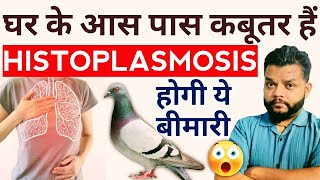 Histoplasmosis Causes Symptoms amp Treatment In Hindi  Histoplasma Capsulatum [upl. by Akenn]