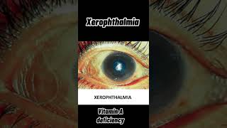 Xerophthalmia nightblindness xeropthalmia in animals animals veterinary vitamin A deficiency [upl. by Price787]