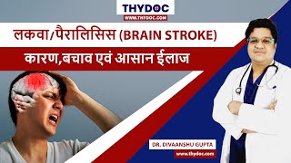 Lakwa Kaise Hota Hai Brain Stroke Treatment Brain Stroke Ke Lakshan Stroke Kya Hota hai [upl. by Schwejda]