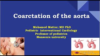 Coarctation of the Aorta [upl. by Slein]