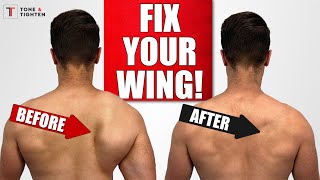 FIX Scapular Winging with Shoulder Blade Exercises [upl. by Asereht]