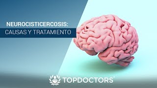 Neurocisticercosis causas y tratamiento [upl. by Filmore]